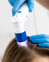 Badanie skóry głowy i włosów  (pierwsza wizyta) + konsultacja